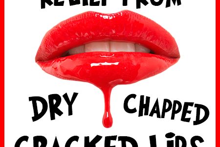 Cracked-Lips