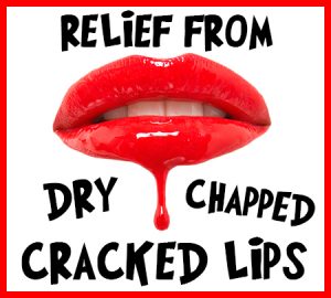 Cracked-Lips