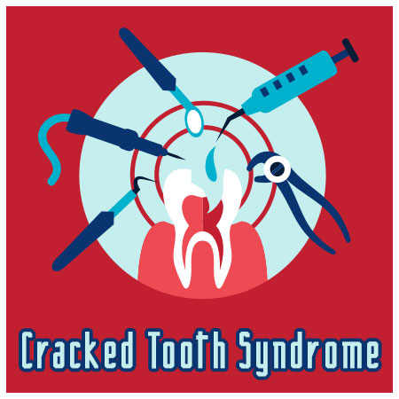 Cracked-Tooth
