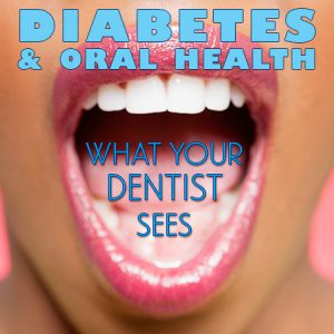 Dental-Diabetes