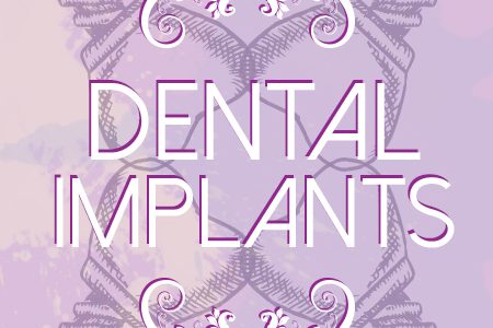 Dental-Implants-facts