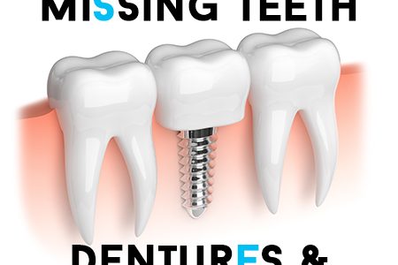 Dentures-Implants
