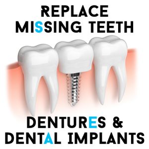 Dentures-Implants
