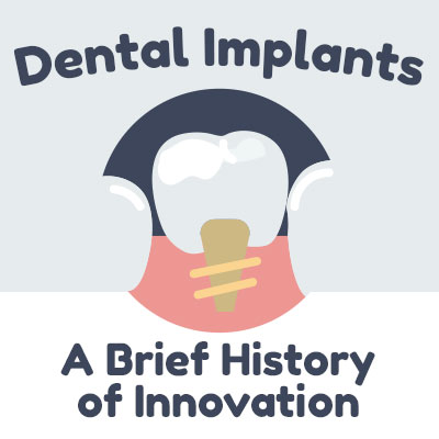 History-of-Implants