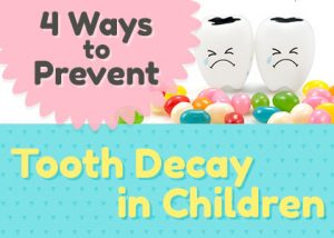 Prevent-Tooth-Decay-in-Kids